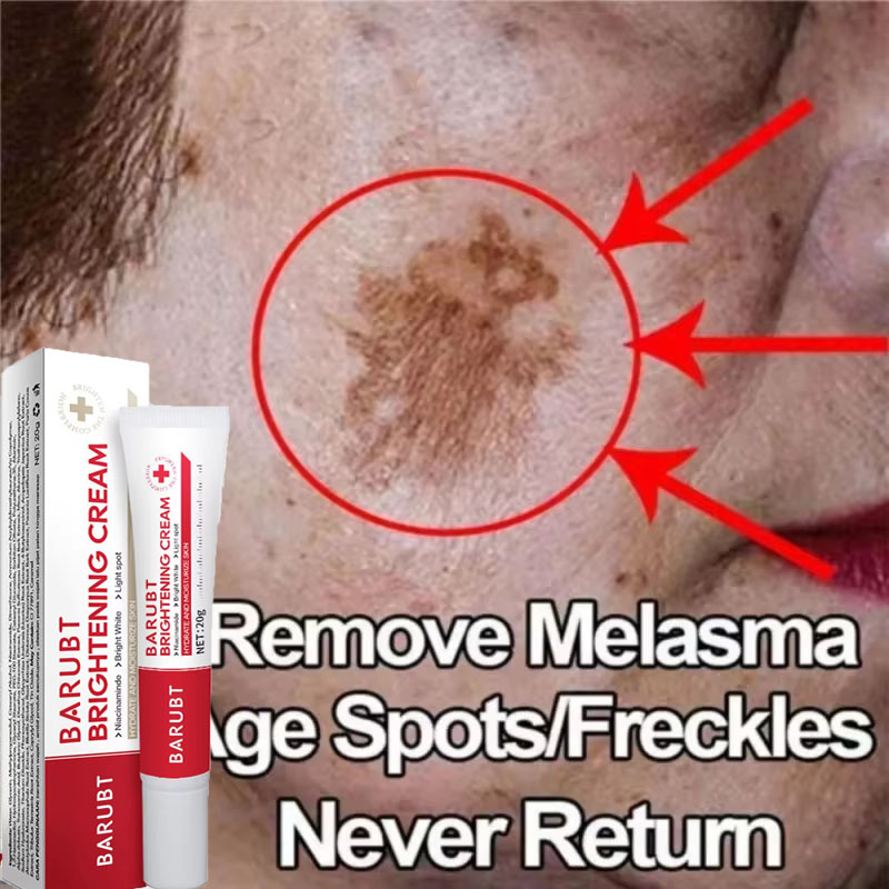 Skincare Vitamin C - Krim Pemutih Penghilang Noda Ampuh Mencerahkan
