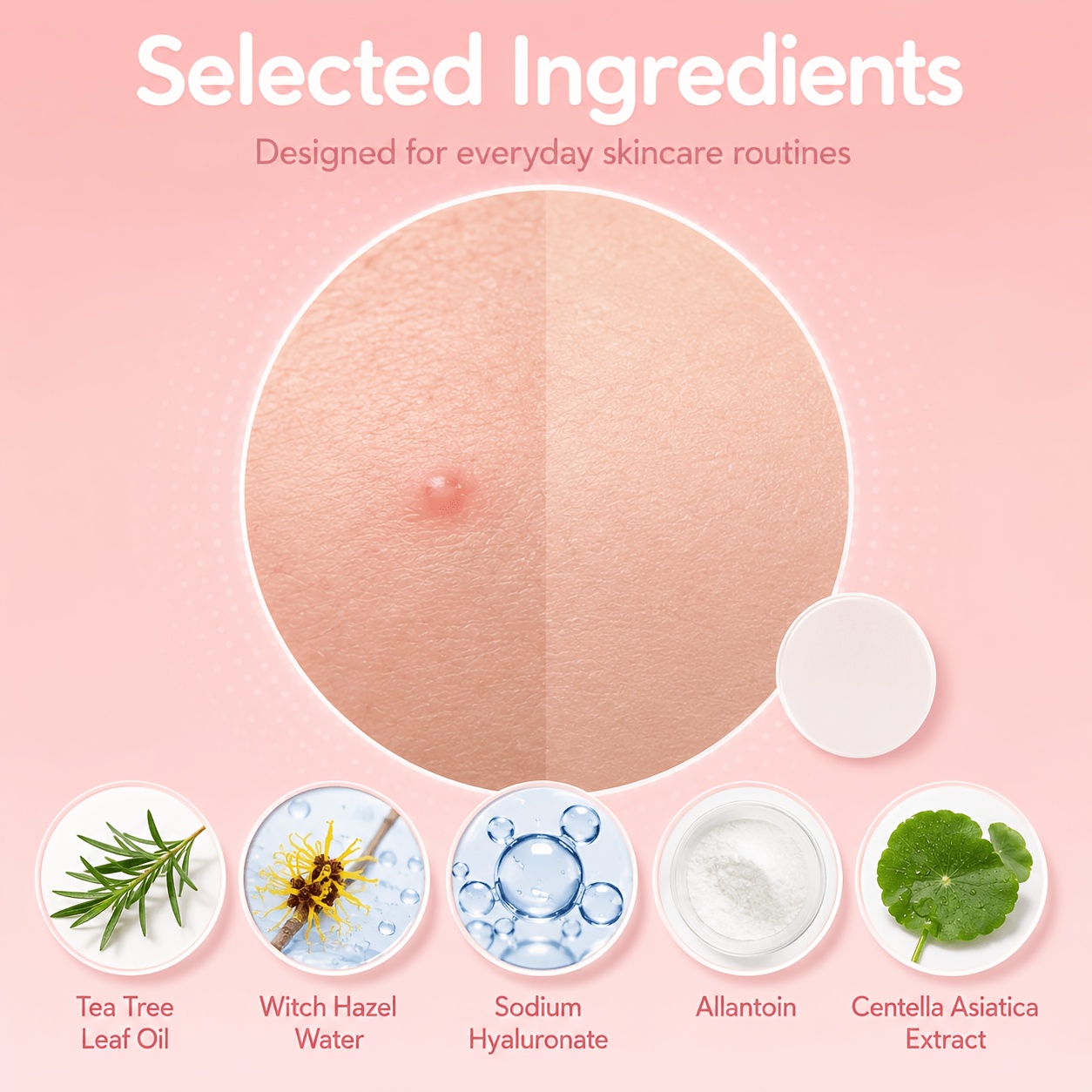 240/480/720pcs Plester Penutup - Hydrocolloid Acne Patch ulasan dan harga