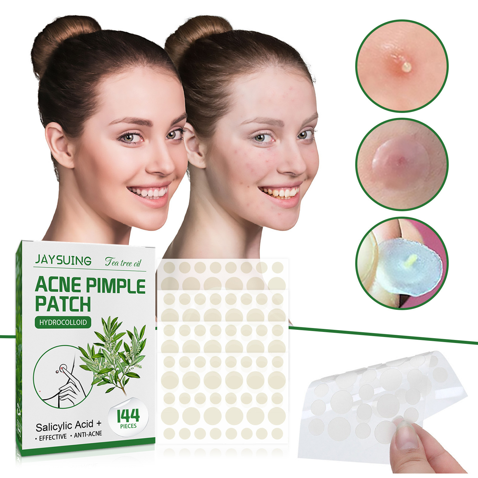 Patch Jerawat Hidrokoloid - Me - Hydrocolloid Acne Patch ulasan dan harga